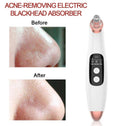 USB Blackhead Remover Vacuum — LED Visual Display Pore Suction Tool